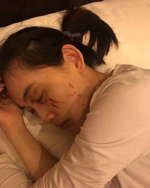 吃瓜被人打伤,被打伤事件引发社会关注