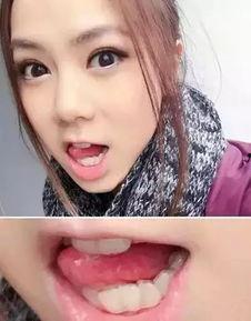 成人简单整牙教程视频大全